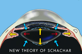 New Theory Of Schachar 